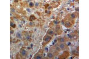 IHC-P analysis of Liver tissue, with DAB staining. (PLG anticorps  (AA 582-812))