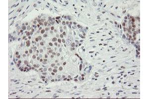 Image no. 13 for anti-Replication Factor C (Activator 1) 2, 40kDa (RFC2) (AA 1-234) antibody (ABIN1490616)