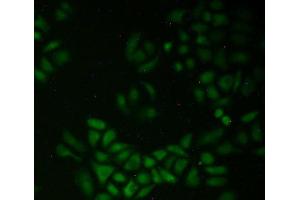 Figure. (QSOX1 anticorps  (AA 394-519))