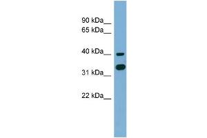 WB Suggested Anti-GPN2 Antibody Titration: 0. (GPN2 anticorps  (Middle Region))