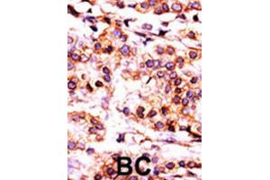 Immunohistochemistry (IHC) image for anti-Pantothenate Kinase 1 (PANK1) antibody (ABIN3003019) (PANK1 anticorps)
