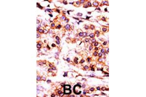 Immunohistochemistry (IHC) image for anti-Pantothenate Kinase 1 (PANK1) antibody (ABIN3003019)
