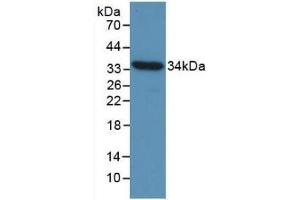 Detection of Recombinant CCND1, Gallus using Monoclonal Antibody to Cyclin D1 (CCND1) (Cyclin D1 anticorps  (AA 1-292))