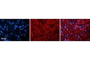 Rabbit Anti-KCNN3 Antibody    Formalin Fixed Paraffin Embedded Tissue: Human Adult heart  Observed Staining: Membrane Primary Antibody Concentration: 1:600 Secondary Antibody: Donkey anti-Rabbit-Cy2/3 Secondary Antibody Concentration: 1:200 Magnification: 20X Exposure Time: 0. (KCNN3 anticorps  (C-Term))
