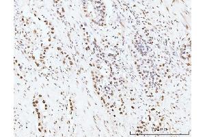 IHC analysis of KIFC1 using anti-KIFC1 antibody (ABIN7599523). (KIFC1 anticorps  (AA 1-673))
