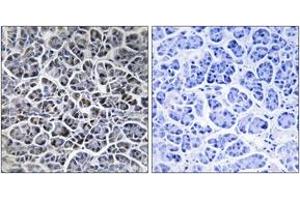 Immunohistochemistry analysis of paraffin-embedded human pancreas tissue, using PPM1K Antibody.