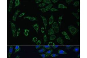 Immunofluorescence analysis of L929 cells using AEBP1 Polyclonal Antibody at dilution of 1:100 (40x lens). (AEBP1 anticorps)