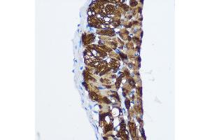 Immunohistochemistry of paraffin-embedded Rat lung using PP1 beta Rabbit pAb (ABIN3021408, ABIN3021409, ABIN3021410 and ABIN6215019) at dilution of 1:100 (40x lens). (PPP1CB anticorps  (AA 1-327))