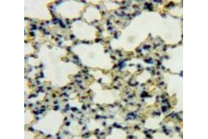IHC-P analysis of Lung tissue, with DAB staining. (DEFB119 anticorps  (AA 22-84))