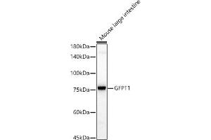 Western blot analysis of extracts of Mouse large intestine, using GFPT1 antibody (ABIN7267430) at 1:1000 dilution. (GFPT1 anticorps)