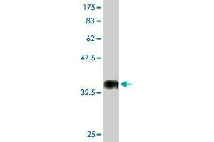 Western Blot detection against Immunogen (35. (CDADC1 anticorps  (AA 423-514))
