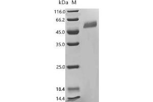 (Tris-Glycine gel) Discontinuous SDS-PAGE (reduced) with 5 % enrichment gel and 15 % separation gel.
