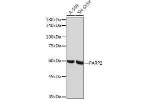 Western blot analysis of extracts of various cell lines, using P Rabbit mAb (ABIN7269441) at 1:1000 dilution. (PARP2 anticorps)