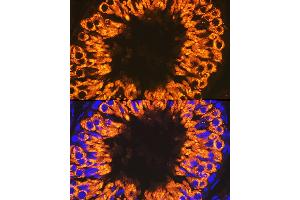 Immunofluorescence analysis of rat testis cells using Calmegin Rabbit mAb (ABIN7266026) at dilution of 1:100 (40x lens).