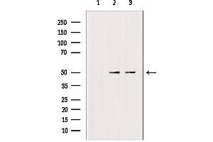 Western blot analysis of extracts from various samples, using TRIM24 Antibody. (TRIM24 anticorps  (C-Term))