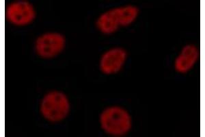 ABIN6269183 staining HeLa by IF/ICC.