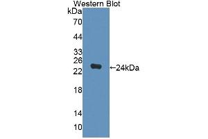 Figure. (DPEP2 anticorps  (AA 303-486))