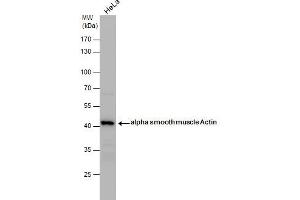 WB Image alpha smooth muscle Actin antibody detects alpha smooth muscle Actin protein by western blot analysis.