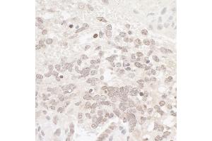Immunohistochemistry (IHC) image for anti-Casein Kinase 2 alpha 1 (CSNK2A1) (AA 300-350) antibody (ABIN7454514) (CSNK2A1/CK II alpha anticorps  (AA 300-350))