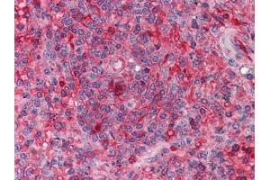 Immunohistochemical analysis of paraffin-embedded human Spleen tissues using anti-ARNTL antibody (ARNTL anticorps)