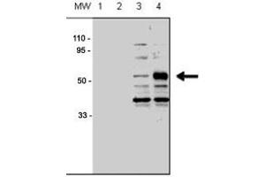 Western blot analysis of ACVRL1 polyclonal antibody  in human chondrocytes (C-28/I2 cells), transfected with empty vector (lane 1, 3) or ACVRL1 (lane 2, 4). (ACVRL1 anticorps  (N-Term))