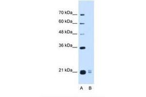 Image no. 1 for anti-Placenta-Specific 1-Like (PLAC1L) (AA 71-120) antibody (ABIN6739219) (PLAC1L anticorps  (AA 71-120))