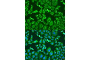 Immunofluorescence analysis of U2OS cells using KIF11 antibody.