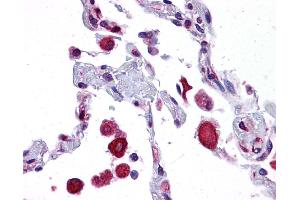 EIF2AK1 antibody was used for immunohistochemistry at a concentration of 4-8 ug/ml. (EIF2AK1 anticorps  (N-Term))