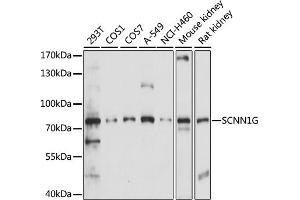 Western blot analysis of extracts of various cell lines, using SCNN1G antibody (ABIN7270387) at 1:1000 dilution.