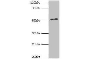 Western blot All lanes: RAD18 antibody at 2 μg/mL + COLO205 whole cell lysate Secondary Goat polyclonal to rabbit IgG at 1/10000 dilution Predicted band size: 57 kDa Observed band size: 57 kDa (RAD18 anticorps  (AA 1-495))