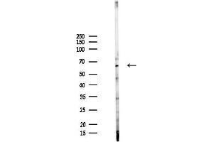 anti-UDP Glucuronosyltransferase 2 Family, Polypeptide B28 (UGT2B28) antibody