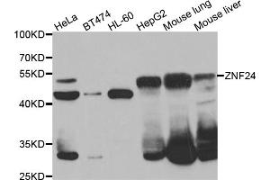 Western blot analysis of extracts of various cell lines, using ZNF24 antibody (ABIN5975578) at 1/1000 dilution. (ZNF24 anticorps)
