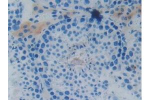 Detection of MAPT in Mouse Testis Tissue using Polyclonal Antibody to Tau Protein (MAPT)