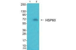 Western blot analysis of extracts from JK cells (Lane 2), using HSP60 antiobdy. (HSPD1 anticorps)