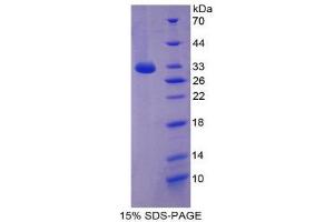 SDS-PAGE (SDS) image for Mitogen-Activated Protein Kinase 10 (MAPK10) (AA 88-332) protein (His tag) (ABIN2125893)