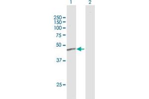 Western Blot analysis of ERCC8 expression in transfected 293T cell line by ERCC8 MaxPab polyclonal antibody.