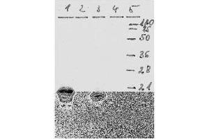 anti-Human Papilloma Virus 18 E7 (HPV-18 E7) (AA 36-70) antibody