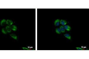 ICC/IF Image LYRIC antibody [N2C3] detects LYRIC protein at cytoplasm and nucleus by immunofluorescent analysis.
