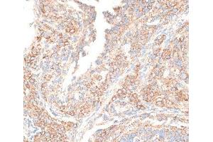 Immunohistochemistry of paraffin-embedded Rat ovary using KIF14 Polyclonal Antibody at dilution of 1:100 (40x lens).