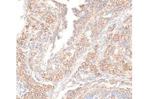 Immunohistochemistry of paraffin-embedded Rat ovary using KIF14 Polyclonal Antibody at dilution of 1:100 (40x lens). (KIF14 anticorps)