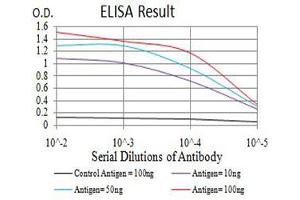 Black line: Control Antigen (100 ng),Purple line: Antigen (10 ng), Blue line: Antigen (50 ng), Red line:Antigen (100 ng)
