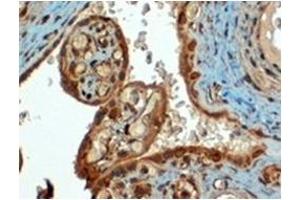 Image no. 3 for anti-CD274 (PD-L1) (C-Term) antibody (ABIN374512) (PD-L1 anticorps  (C-Term))