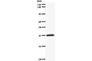Western Blotting (WB) image for anti-Nuclear Factor (erythroid-Derived 2)-Like 2 (NFE2L2) antibody (ABIN931118) (NRF2 anticorps)