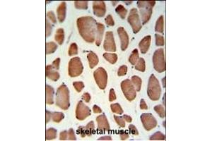 HSD11B2 Antibody (Center) (ABIN653721 and ABIN2843030) IHC analysis in formalin fixed and paraffin embedded skeletal muscle followed by peroxidase conjugation of the secondary antibody and DAB staining.