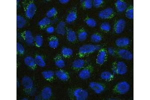 IF analysis of VTCN1 using anti-VTCN1 antibody (ABIN7602060).