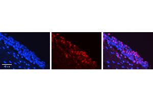Rabbit Anti-FOSL1 Antibody Catalog Number: ARP31377_P050 Formalin Fixed Paraffin Embedded Tissue: Human Urinary Bladder Tissue Observed Staining: Nucleus Primary Antibody Concentration: 1:100 Other Working Concentrations: 1:600 Secondary Antibody: Donkey anti-Rabbit-Cy3 Secondary Antibody Concentration: 1:200 Magnification: 20X Exposure Time: 0.