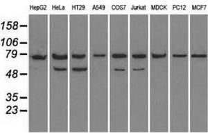Western blot analysis of extracts (35 µg) from 9 different cell lines by using anti-HSPA9 monoclonal antibody. (HSPA9 anticorps)