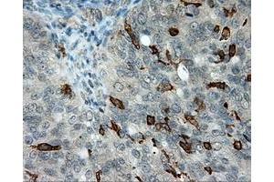 Immunohistochemical staining of paraffin-embedded Kidney tissue using anti-LIPG mouse monoclonal antibody. (LIPG anticorps)