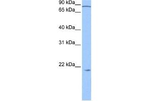 WB Suggested Anti-ARPC3 Antibody Titration: 0. (ARPC3 anticorps  (N-Term))