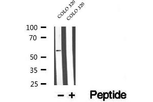 Western blot analysis of extracts of COLO 320 cells, using WSB1 antibody. (WSB1 anticorps  (Internal Region))